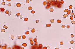 Particles from the red rain